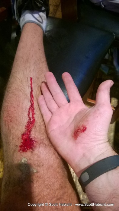 What happens when you go too fast on your bike and the roads are wet.