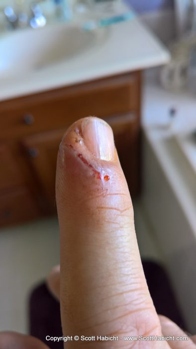 Not paying attention while cleaning a VERY sharp knife led to a trip to urgent care.